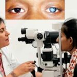 "Have you started developing cataracts?