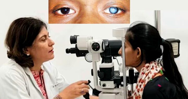 "Have you started developing cataracts?